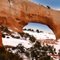 Wilson's arch
