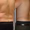 Tummy Tuck Camarillo, CA - Pacifica Institute 4