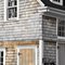 Shingles